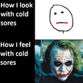 cold sores suck